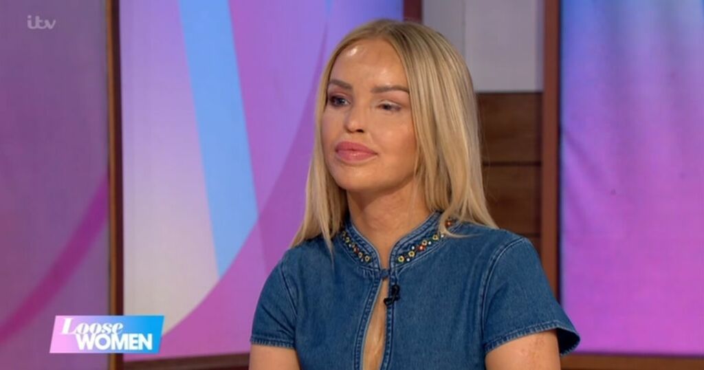 ITV Loose Women S Katie Piper S Humble Response As She