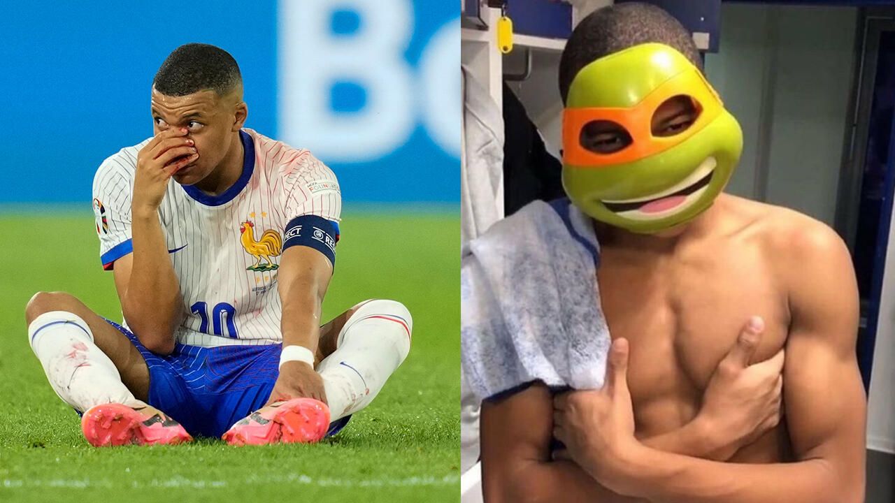 Injured Mbappé asks for mask ideas and receives