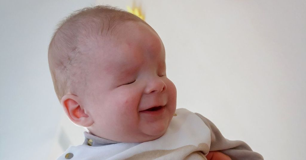 'Smiley' baby born with no eyes finally finds loving…