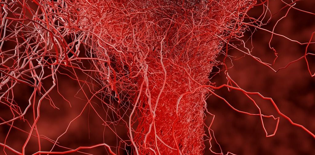 What is capillary leak syndrome and is it linked to…