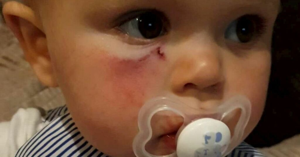 Toddler rushed to hospital after being mauled in the…