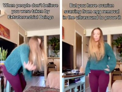 Woman tells TikTok she was abducted by aliens and has scarring to ‘prove it’