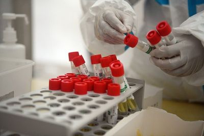 Update: Beijing Reports First Local Omicron Case