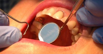 Merseyside dentists drop out of NHS amid warning of a 'staff crisis'