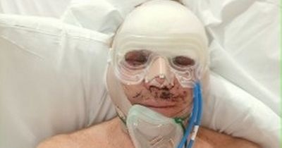 Pensioner unable to shut his eyes for three YEARS after 'botched' cosmetic surgery