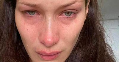 Bella Hadid says she suffered 'excruciating' pain during 'depressive episodes'