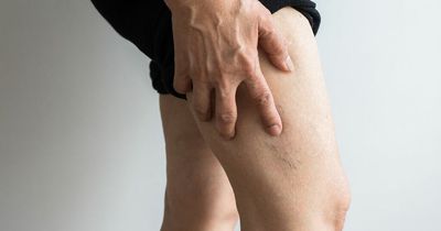 Prostate cancer: 2 strange leg symptoms you should immediately flag to your GP