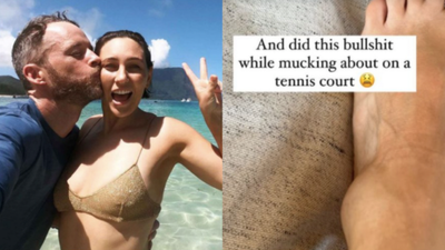 Ya Girl Zoë Foster Blake Suffered A Nasty Injury While On Vacay & The Insta Stories Are Brutal