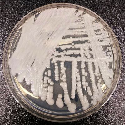 1st for Louisiana: Drug-resistant fungus found at hospital