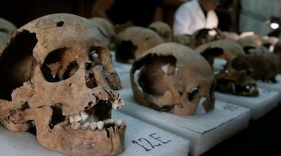 World’s 1st Surgery Took Place in Head of Peruvian Warrior 2,000 Years Ago