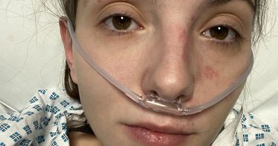 Disney fan's urgent op after B&M glass explodes leaving shards in mouth and tummy