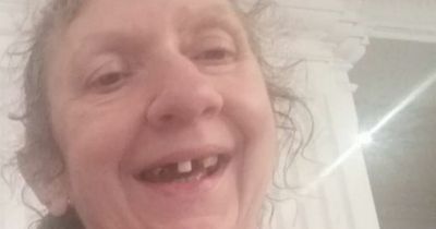 Scots woman 'looks like extra from horror movie' after teeth fall out in lockdown