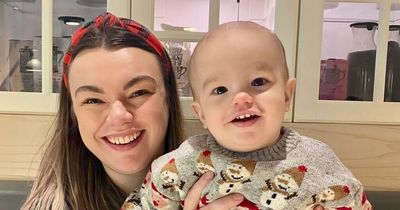 Baby's 'big head' was noticed by doctors in time for life-saving treatment