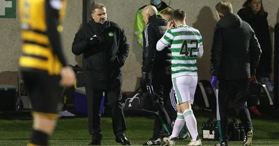 Callum McGregor in Celtic 'broken bone' fear as ex-Hoop recalls his own facial injury recovery timeline