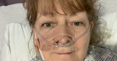 Janey Godley's 'intestines paralysed' in ordeal 'worse than' hysterectomy after tumour removed