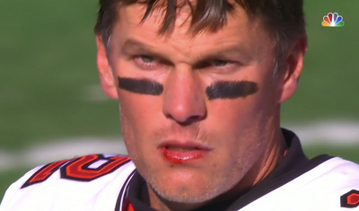 A bleeding Tom Brady bled his own blood and NFL fans made so many memes