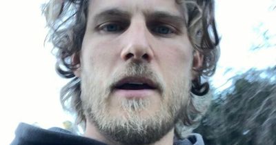 You star Travis Van Winkle shows off bloodied leg from 'scary' coyote attack