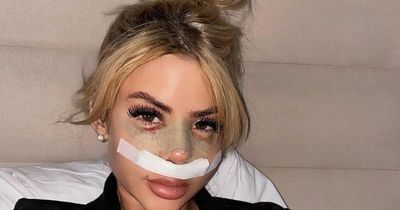Love Island's Hannah Elizabeth reveals results of nose job after Turkey trip