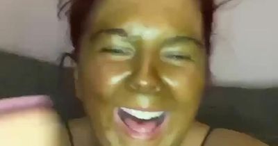 Pale woman looked like Shrek when fake tan turned her green