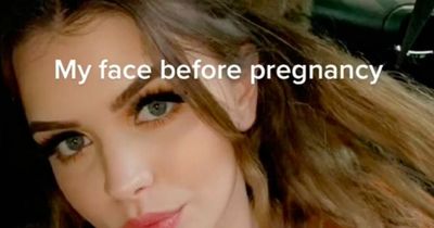 Mum shares dramatic pictures of before and during pregnancy and she's unrecognisable