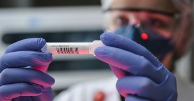 People who take PCR tests will now be told whether they have flu or respiratory syncytial virus (RSV)