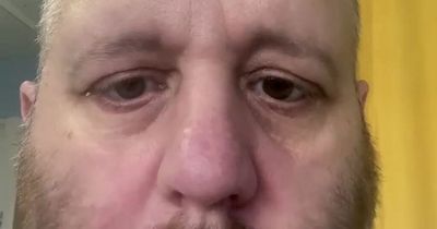 Glasgow man left with 'eyes stuck open' as doctors fear rare cancer