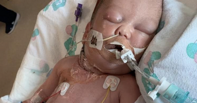 Miracle Scots baby celebrates first birthday after 'final chance' in fight for his life