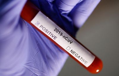 Ivermectin shows ‘antiviral effect’ against COVID, Japanese company says
