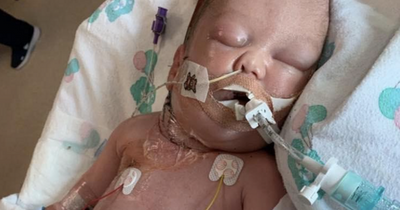 Miracle Wishaw baby celebrates first birthday after 'final chance' in fight for his life