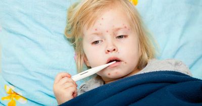 Deadly measles warning to parents as vaccination drops dangerously low