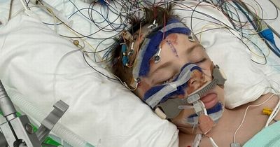 Boy, 8, ended up in coma for 5 days after being hit by car near his home