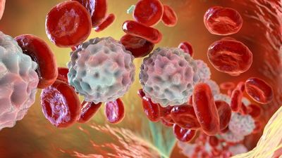 Leukaemia-fighting CAR T-cells kept patients in remission for 10 years — and counting