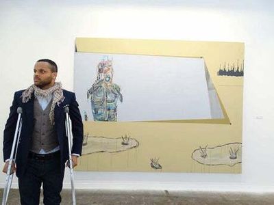 Artist knocked down by stolen moped in London sues for £30m in damages