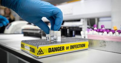 Covid is now 'not that much more deadly' than flu in UK, figures suggest