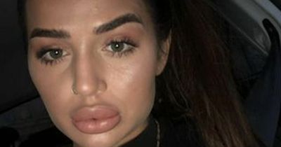 'I had so much filler it deformed my face and I couldn't recognise myself'