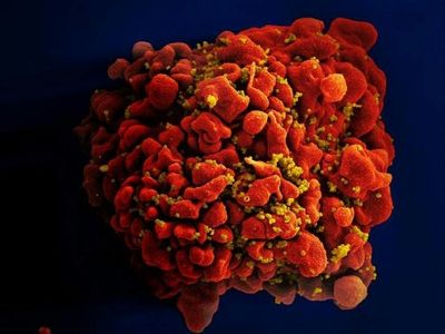 New 'highly virulent' HIV strain discovered in the Netherlands