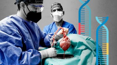 Gene editing: pig hearts and the new era of organ transplants