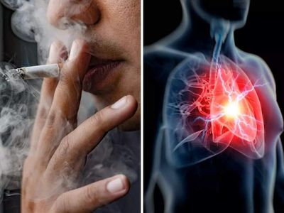 Can smoking cause a heart attack? Doctors answer and explain how