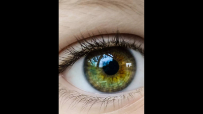 Pune: ‘Measure retinal spider veins to track vision loss’