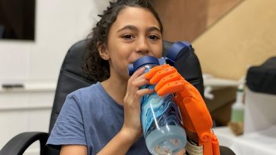 Young amputee embraces 3D-printed hand after lawnmower accident