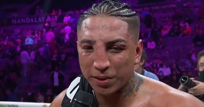 Boxer Mario Barrios left with disfigured nose after losing almost every round of fight