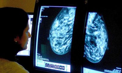 NHS England waiting times for cancer referral and treatment at record high