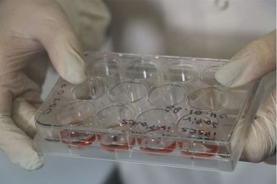 Scientific breakthrough could enable paralysed people to walk again