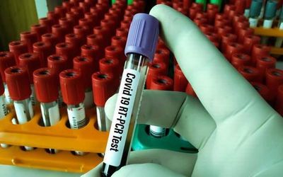 India records 65,000 new cases, 1,169 deaths