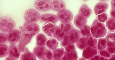 Warning after new cases of super-gonorrhoeae found in England