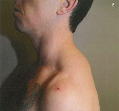 Zachary Rolfe trial: photos reveal stab injury sustained by NT police officer before fatal shooting