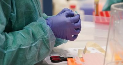 Scottish Government announces 15 deaths and 7,640 covid cases in last 24 hours