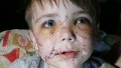 Boy On The Mend After Neighbor’s Dog Shook Him ‘Like A Chew Toy,’ Almost Killing Him