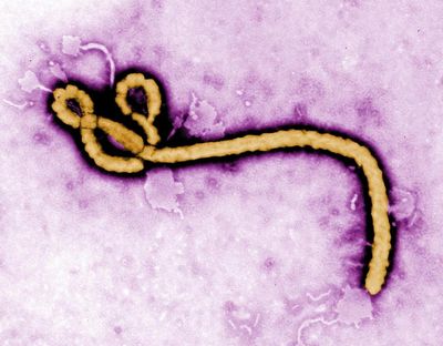 Ebola can lurk in the brain and re-emerge years after recovery to cause fatal disease, study finds