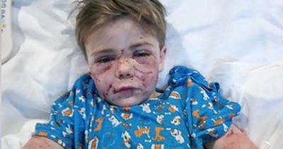 Boy, 7, left with horror injuries after dog viciously attacked him as he got off bus